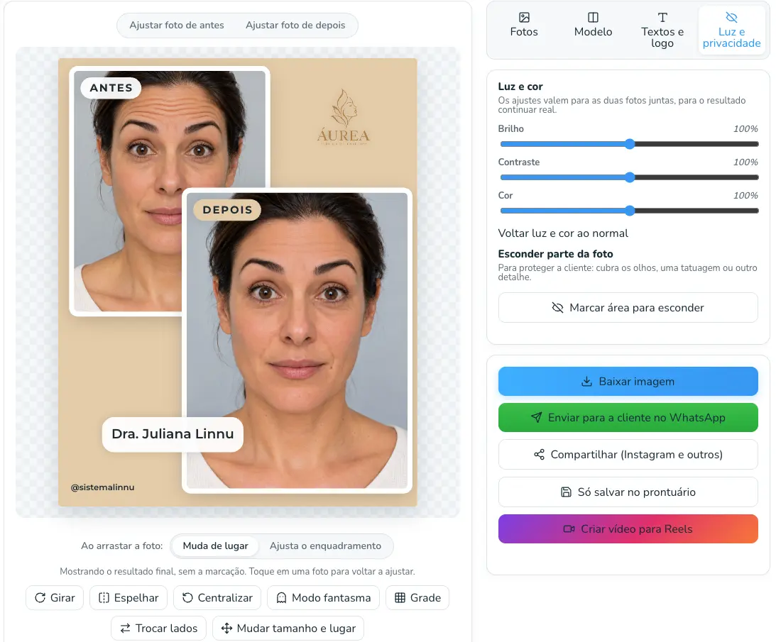 Editor de antes e depois da Linnu: as duas fotos montadas numa arte com a logo da clínica, o nome da profissional e o @ do Instagram, com ajustes de luz e cor, opção de esconder parte da foto e botões para baixar, enviar pelo WhatsApp, compartilhar, salvar no prontuário e criar vídeo para Reels