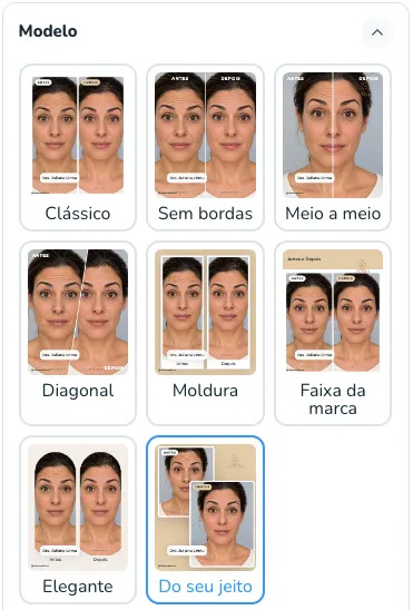 Os 8 modelos de arte de antes e depois: Clássico, Sem bordas, Meio a meio, Diagonal, Moldura, Faixa da marca, Elegante e Do seu jeito