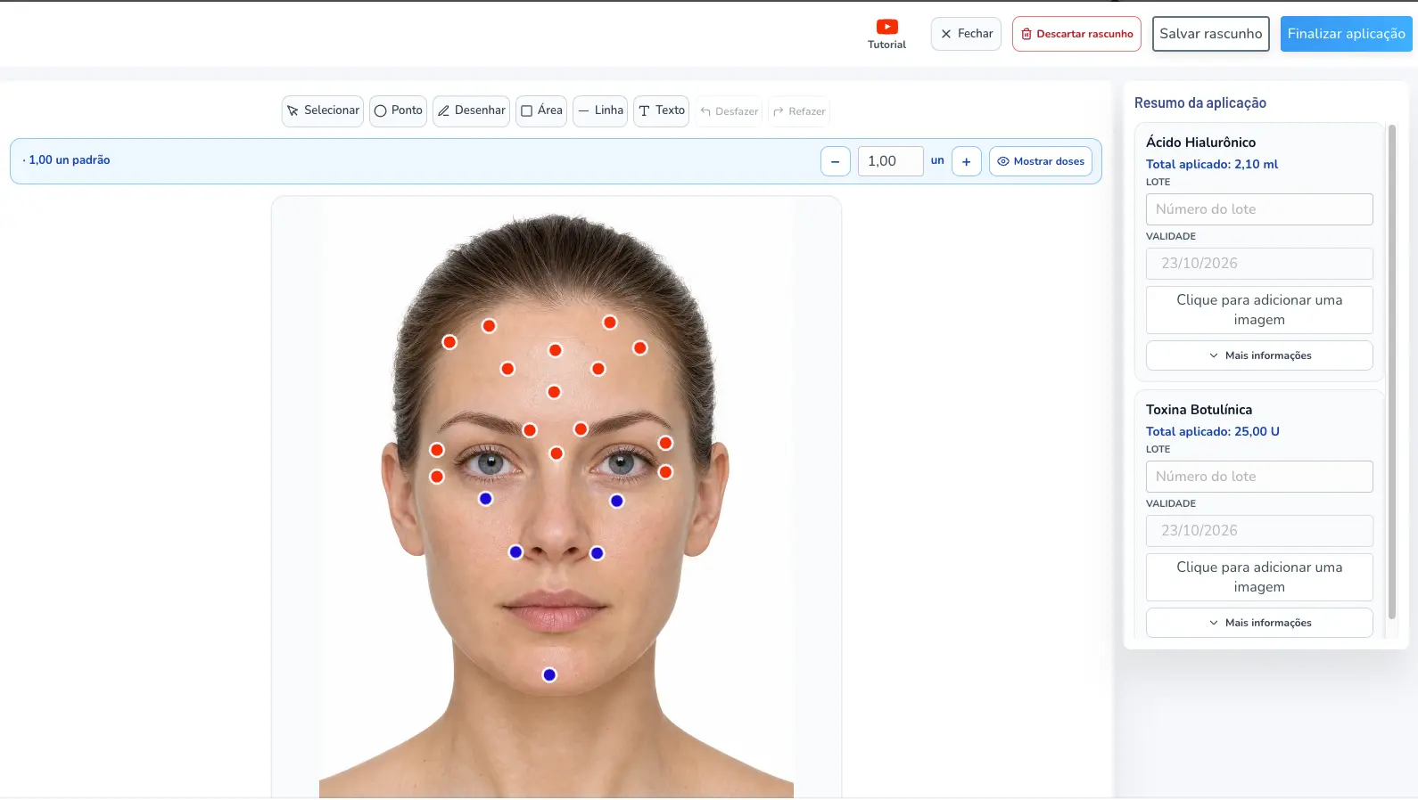 Tela do Mapa de Aplicações da Linnu no computador: modelo facial com pontos de toxina botulínica e de ácido hialurônico e o resumo da aplicação com o total de cada produto e os campos de lote e validade